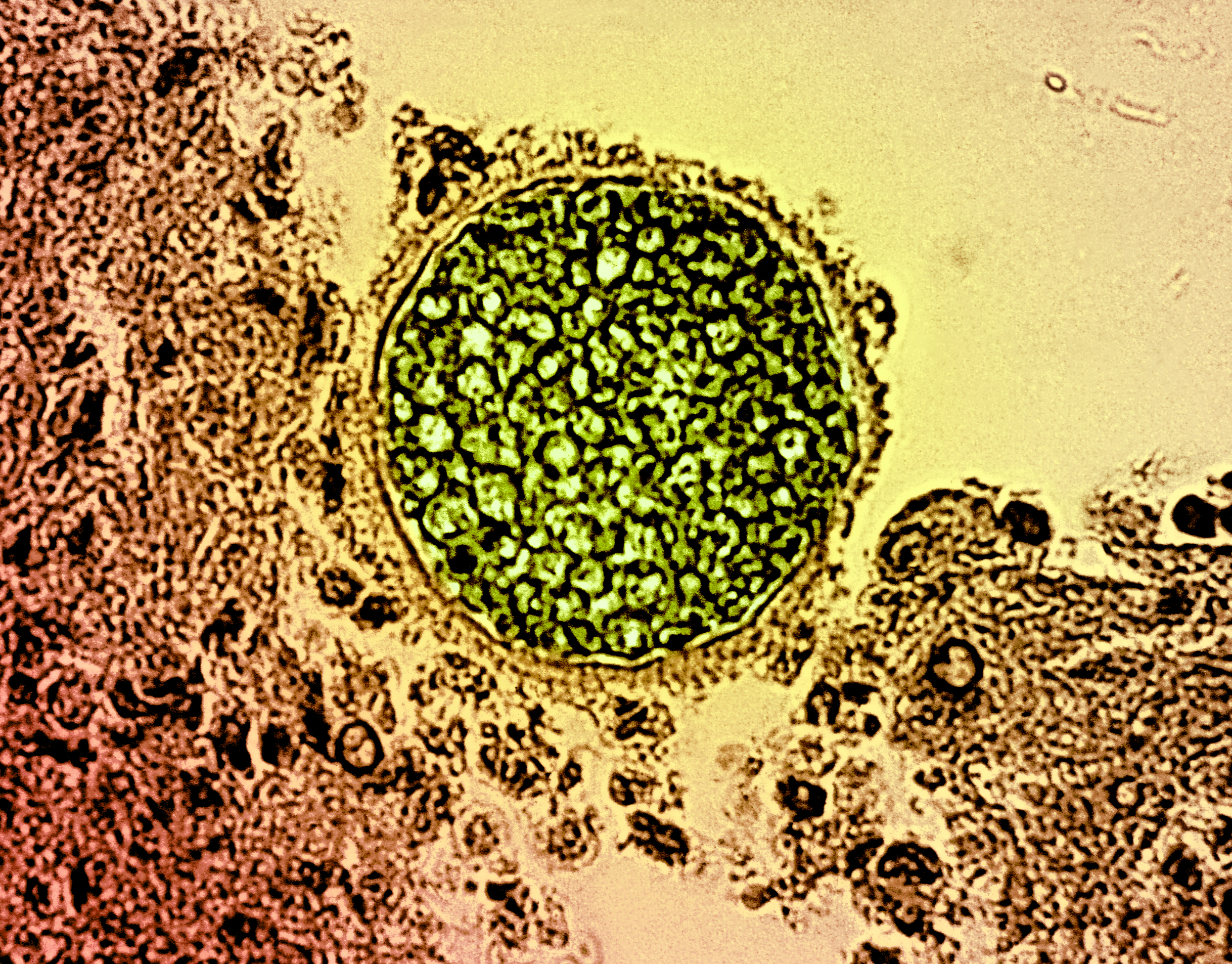 A Coccidioides fungal spherule (green) found in a tissue sample. This organism causes coccidioidomycosis, also known as Valley Fever. Credit: micrograph by CDC; colorization and visual effects by NIAID A Coccidioides fungal spherule (green) found in a tissue sample. This organism causes coccidioidomycosis, also known as Valley Fever. Credit: micrograph by CDC; colorization and visual effects by NIAID