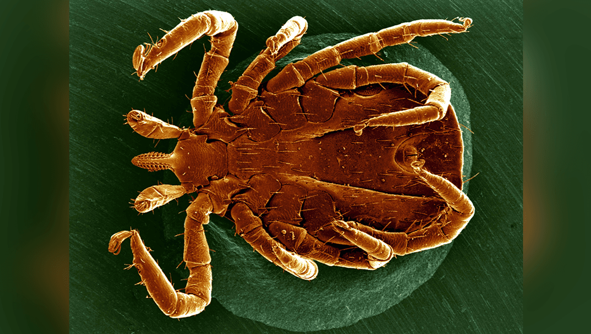 Doctors Warn Of A Tickborne Disease You've Perhaps Never Heard Of Spreading In Parts Of North America