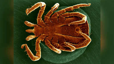 A tick seen under a scanning electron microscopy.