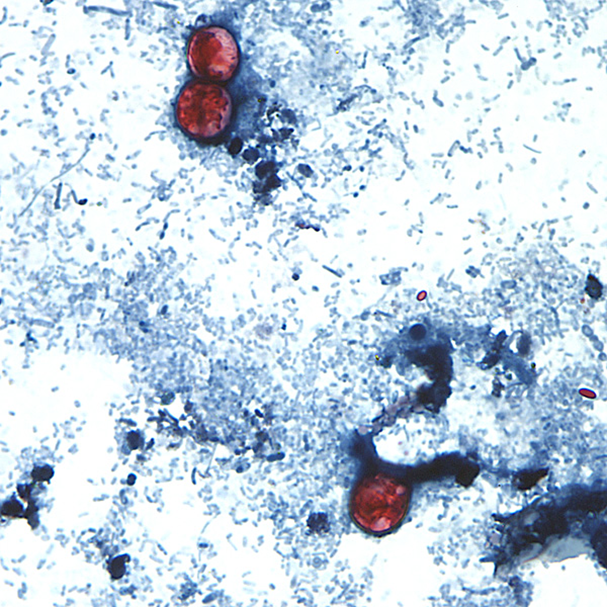 Stained in red, these Cyclospora oocysts aren't infectious yet, but they're lying in wait. Stained in red, these Cyclospora oocysts aren't infectious yet, but they're lying in wait.