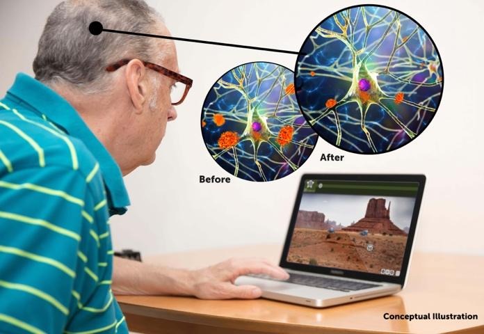 man sitting in front of a laptop with two 3D illustrations representing amyloid plaques in the brain in orange; in the one labelled before, there are several large orange plaques, and in the one labelled after there are much fewer