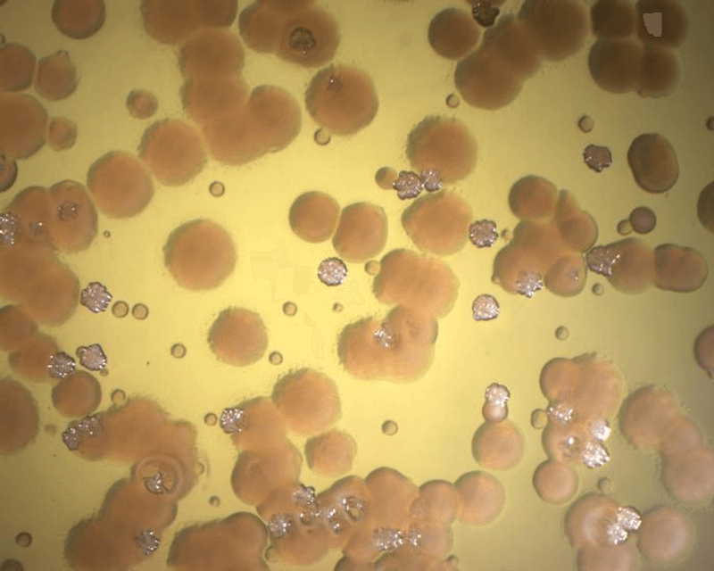 Pseudomonas aeruginosa from a patient with cystic fibrosis. The dangerous pathogen sometimes acquires antibiotic resistance from a relative that doesn't kill on its own.