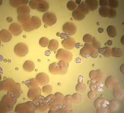 Pseudomonas aeruginosa from a patient with cystic fibrosis. The dangerous pathogen sometimes acquires antibiotic resistance from a relative that doesn't kill on its own.