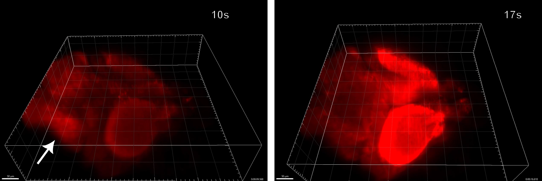 Researchers have developed a new high-resolution light-sheet imaging system that is fast enough to capture images of a seizure propagating through the brain of a larval zebrafish in 3D.  The images show that the seizure starts at the back of the fish and reaches its peak in the optic tecta.