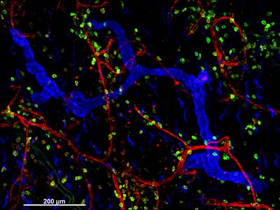 Cellular architecture of normal human skin imaged by whole mount tissue microscopy. Human skin has a rich network of white blood cells (specifically dendritic cells, T cells and macrophages) which form sheaths around blood vessels. In this image, blood vessels (string-like structures stained for CD31; red), lymphatic vessels (ribbon-like structures stained for LYVE-1; blue) and dendritic cells (stained for CD11c; green) can be seen. Macrophages (stained for LYVE-1; blue) are also present.