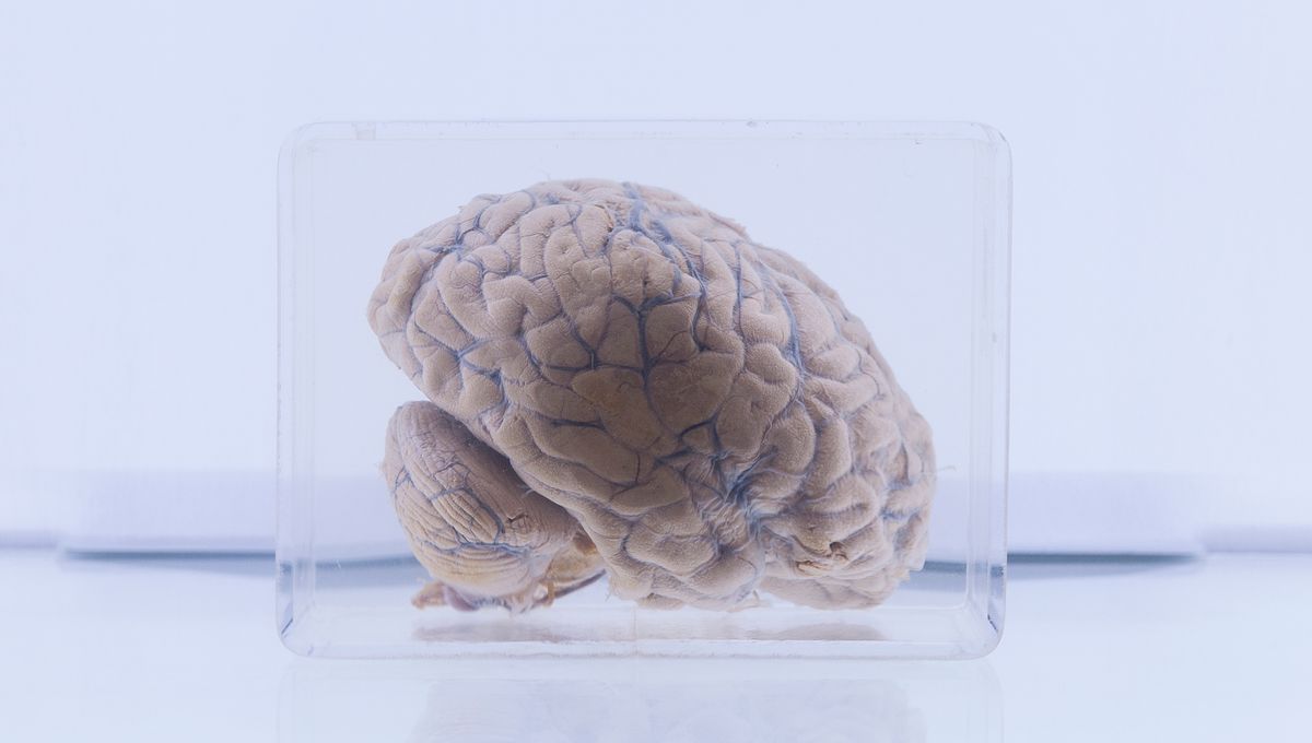 Brain Preservation Paradox Solved: How Some Human Brains Survived For Over 10,000 Years While The Body Decayed
