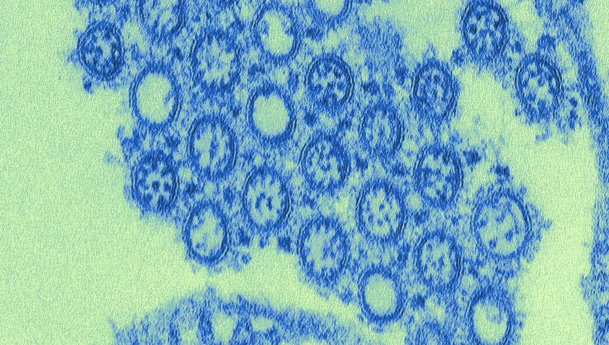 First-Ever mRNA Flu Vaccine Finally Approved By FDA In Time For 2026 Season – After They Initially Refused To Review It