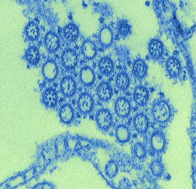 Digitally-colorized transmission electron microscopic image of virions from a 2009 pandemic influenza A (H1N1) virus isolate. The spherical virus particles contain cross-sections through the viral nucleocapsids, seen as dots, enclosed by a distinct viral envelope surrounded by prominent spikes.