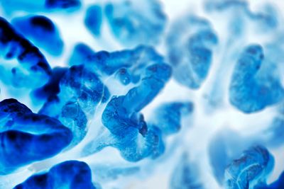 A view of a cancer cell under a microscope. The image shows coils of structures on a blue/white spectrum with negative space appearing as white and more dense parts as increasingly darker blue.
