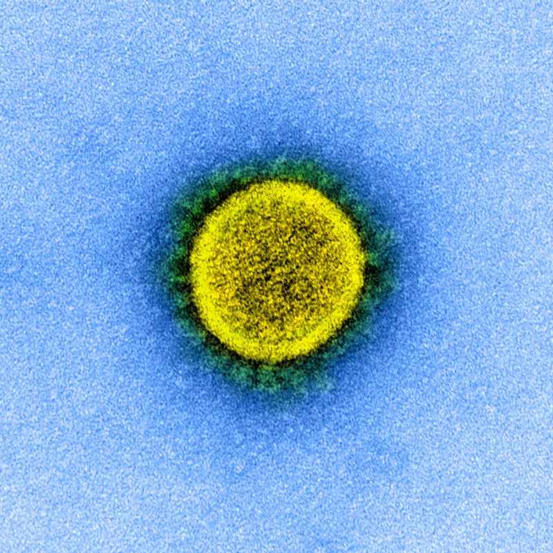 A electron micrograph of a SARS-CoV-2 virus particle.