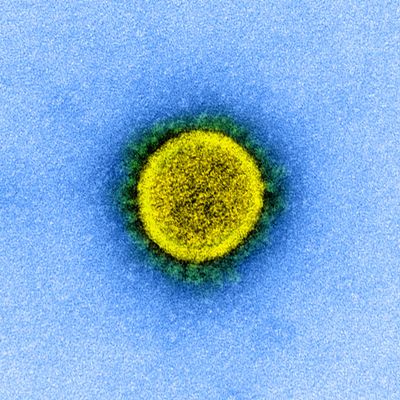 A electron micrograph of a SARS-CoV-2 virus particle.