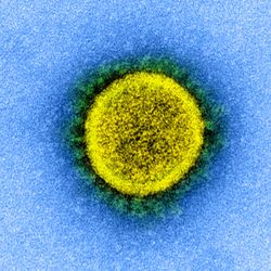 A electron micrograph of a SARS-CoV-2 virus particle. 