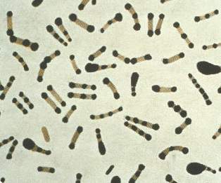 A photomicrograph of Corynebacterium diphtheriae taken from an 18 hour culture, and using Albert's stain. A photomicrograph of Corynebacterium diphtheriae taken from an 18 hour culture, and using Albert's stain.