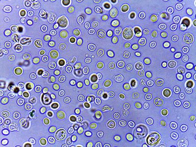 yeast cells under a microscope