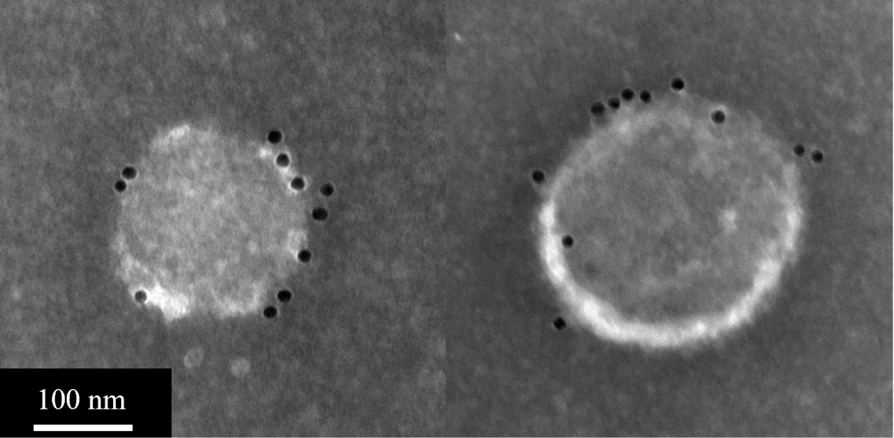 Vaccine particles loaded with influenza M2 protein, which are highlighted with black dots. This flu marker mutates more slowly, potentially enabling the vaccine to provide longer immunity. Vaccine particles loaded with influenza M2 protein, which are highlighted with black dots. This flu marker mutates more slowly, potentially enabling the vaccine to provide longer immunity.