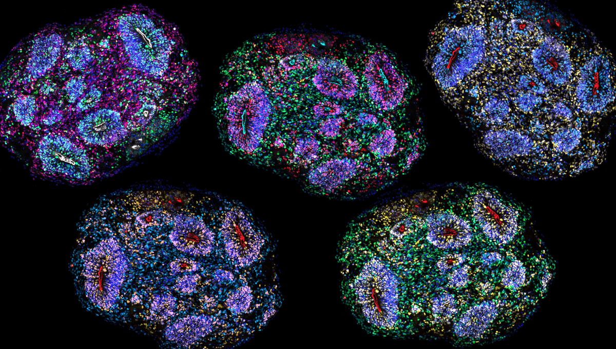 Record-Breaking Human Mini Brains Kept Alive For 5 Years And Appear To Age Like The Real Thing