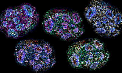 A composite mosaic of human brain organoids that have been immunolabelled for different cell type markers.