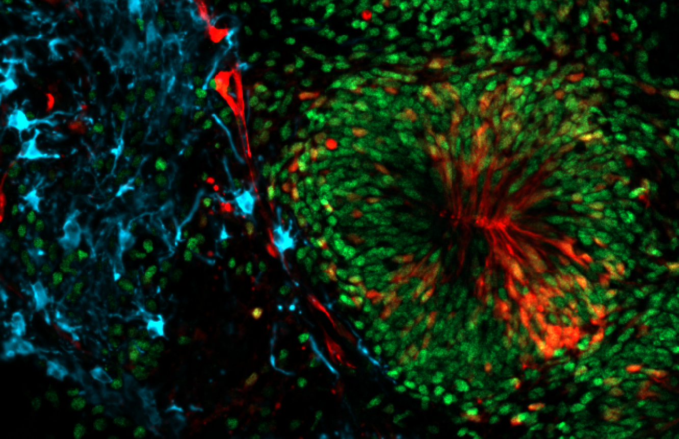 A close-up of an organoid immunolabelled for different cell type markers. A close-up of an organoid immunolabelled for different cell type markers.