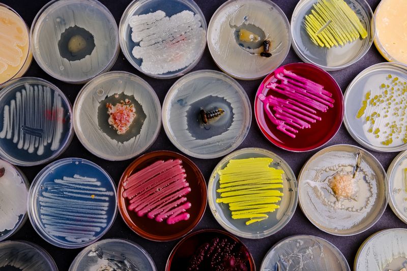 rows of agar plates with different coloured microorganisms growing on them