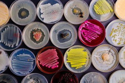 rows of agar plates with different coloured microorganisms growing on them