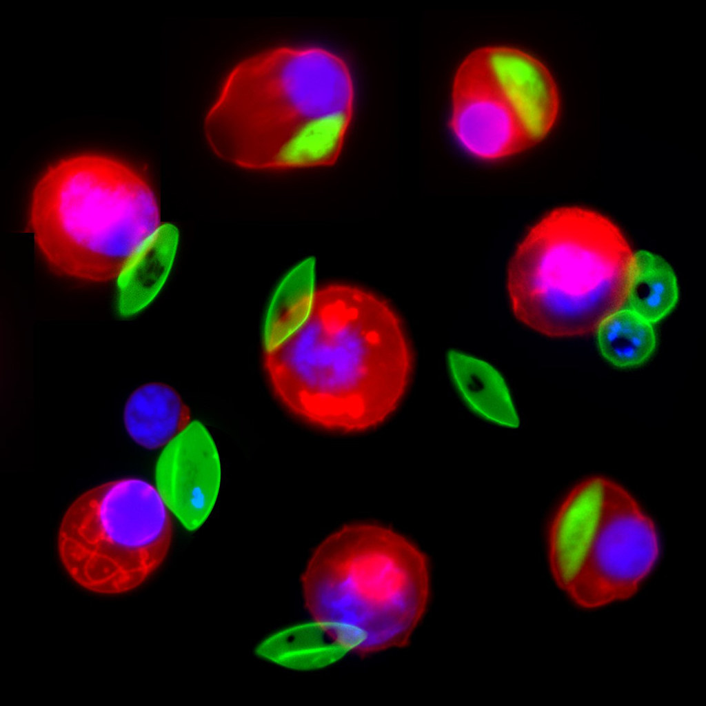 colorful microscope image of plasmodium parasites (green) infecting red blood cells colorful microscope image of plasmodium parasites (green) infecting red blood cells