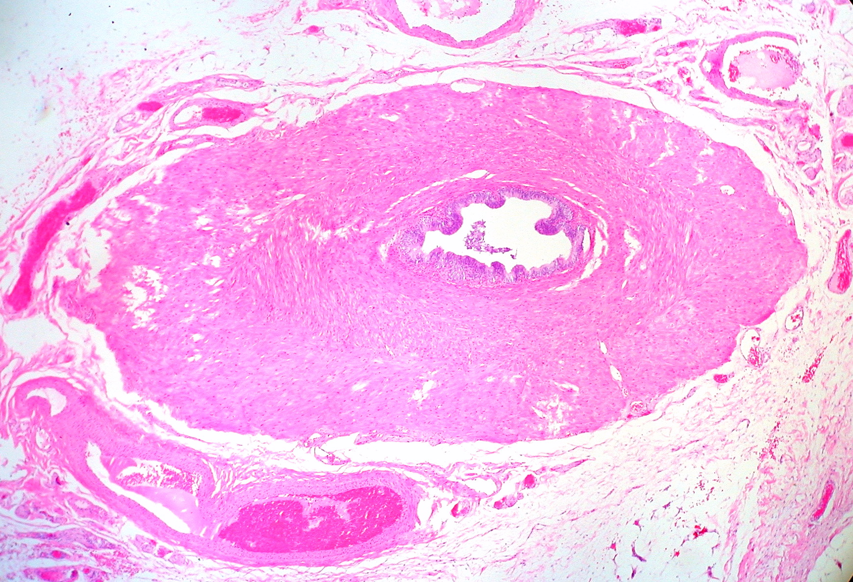 pink stained microscope image of a cross section of a human vas deferens pink stained microscope image of a cross section of a human vas deferens