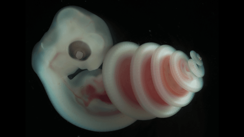 a snake embryo has its head at one end, and its lower body coiled into a spiral