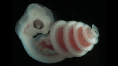a snake embryo has its head at one end, and its lower body coiled into a spiral