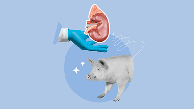illustration of a pig with a gloved human hand above it holding a kidney