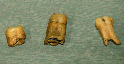 Neanderthal teeth