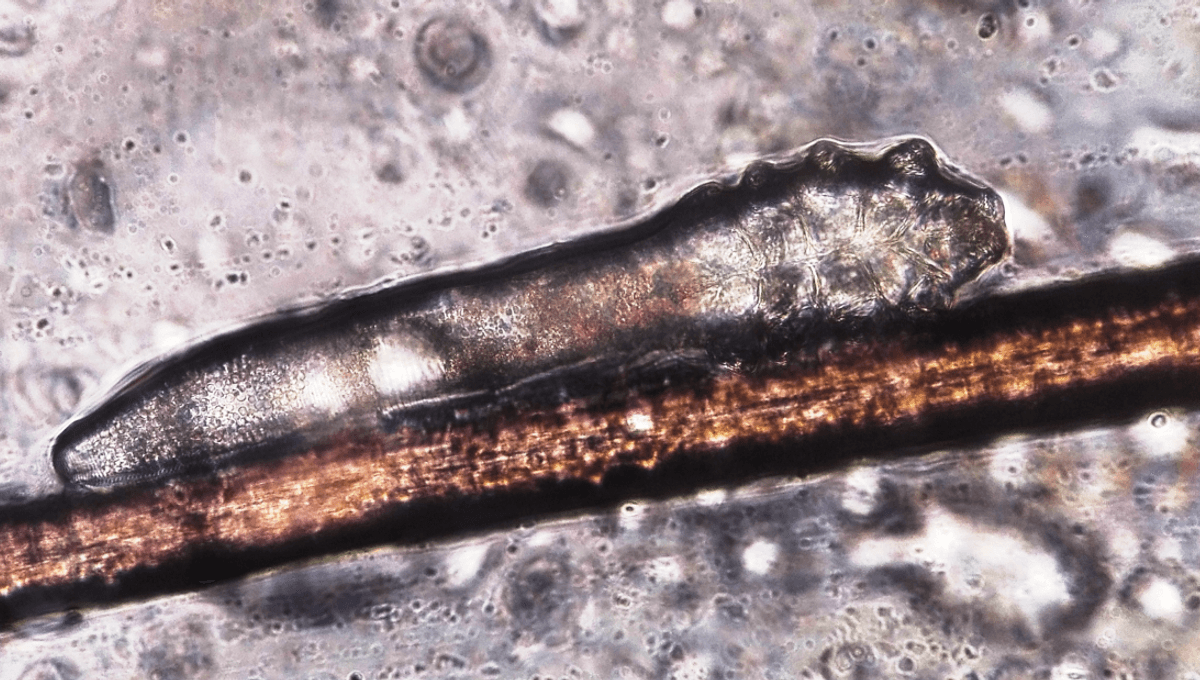 Love False Lashes? Me Too, Says Microscopic Arachnid That Lives On Your Face