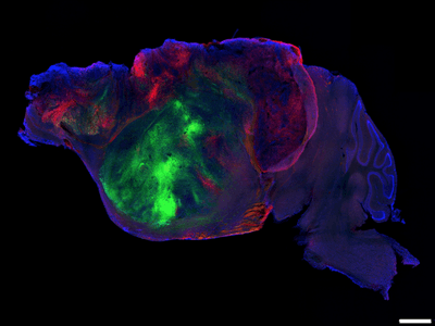 Side view of a xenocortical mouse brain showing nerve fibers extending from the human graft (colored with green and red fluorescent proteins) through the mouse brain (blue).   Scale bar = 1 mm. 