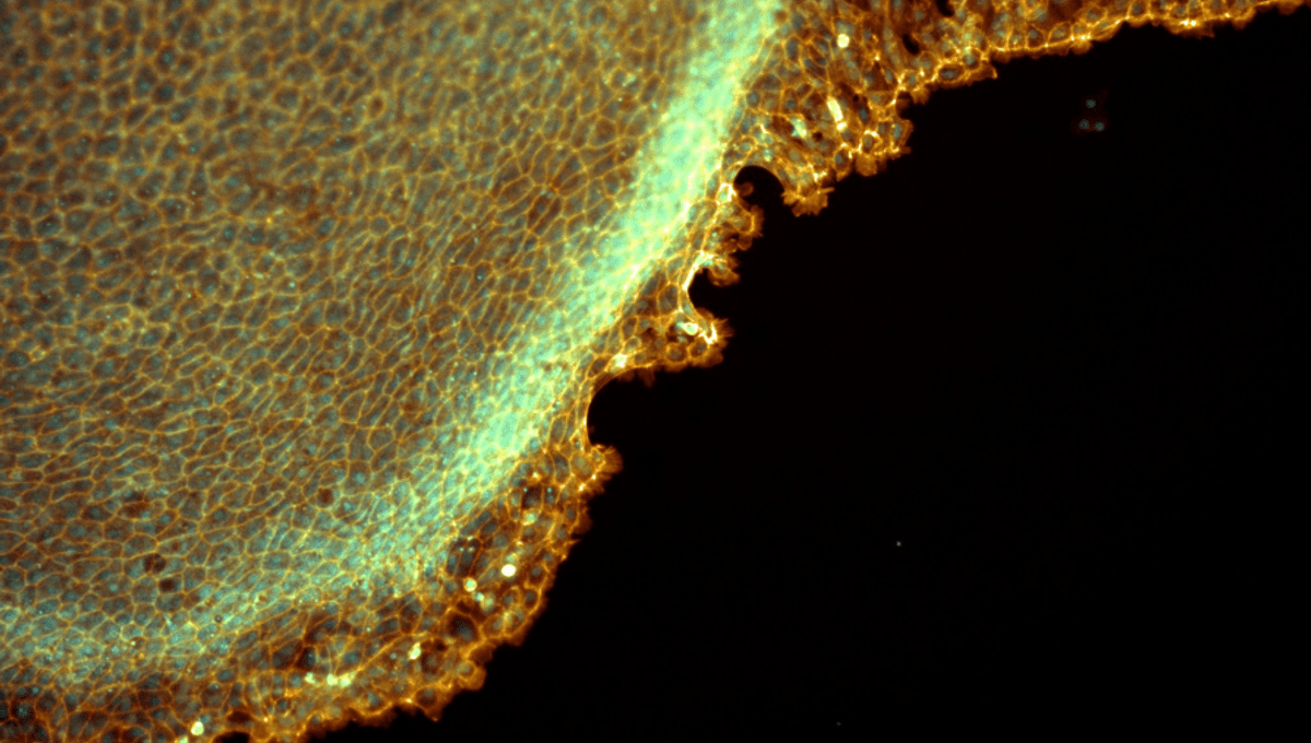 Photo: iflscience.com For The First Time, Scientists Have Looked Inside Living Antarctic Cells And Found Their Incredible Adaptations