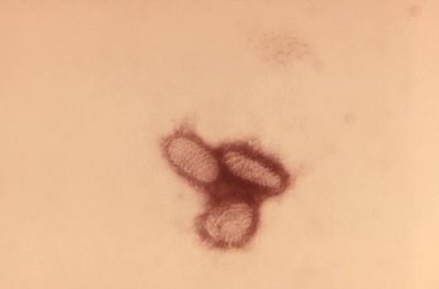 A transmission electron microscopic image of three poxviruses.