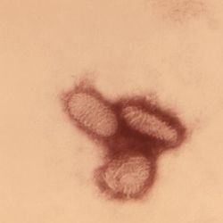A transmission electron microscopic image of three poxviruses. 
