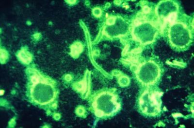 Photomicrograph of a human specimen obtained from a plague patient, revealing numerous rod-shaped bacteria, Yersinia pestis.