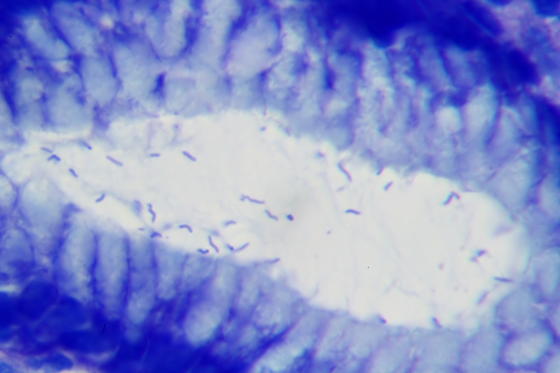 blue stained tissue with a large white area in the middle containing several small rod-shaped organisms blue stained tissue with a large white area in the middle containing several small rod-shaped organisms