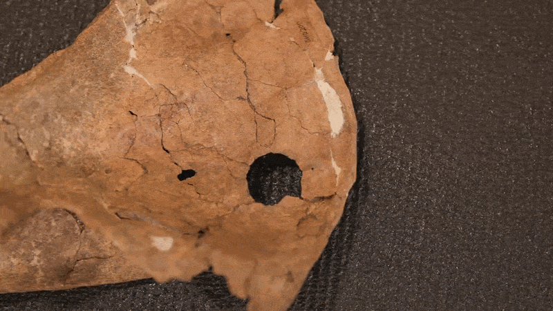 Film of the Shanidar A scapula, filmed with Dr Emma Pomeroy in the University of Cambridge’s Leverhulme Centre for Human Evolutionary Studies. Film of the Shanidar A scapula, filmed with Dr Emma Pomeroy in the University of Cambridge’s Leverhulme Centre for Human Evolutionary Studies.