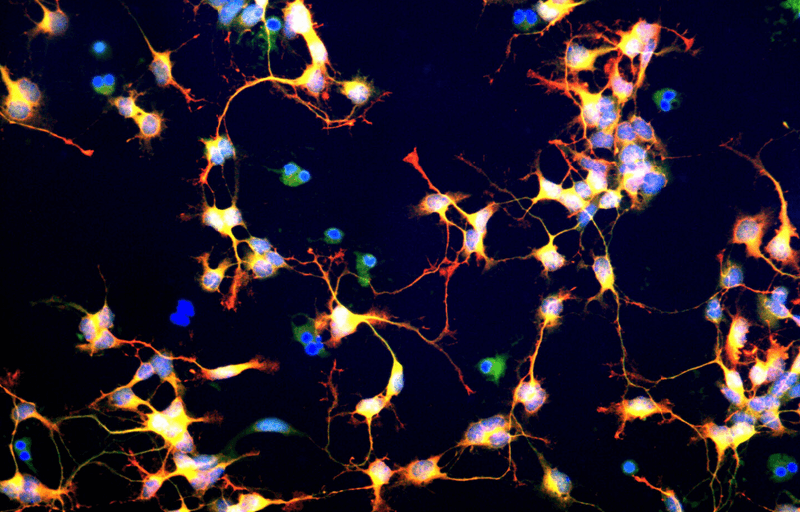 A microscopic image of differentiating neuroblasts, primitive nerve cells that develop into neurons and glial cells.
