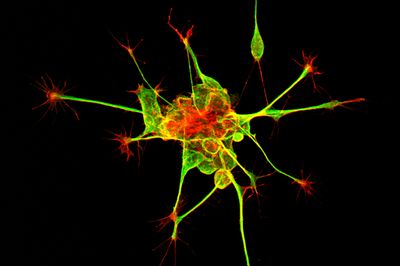 green and red stained dorsal root ganglion neuron in culture, on a black background